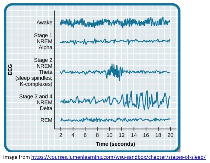 EEG sleep waves